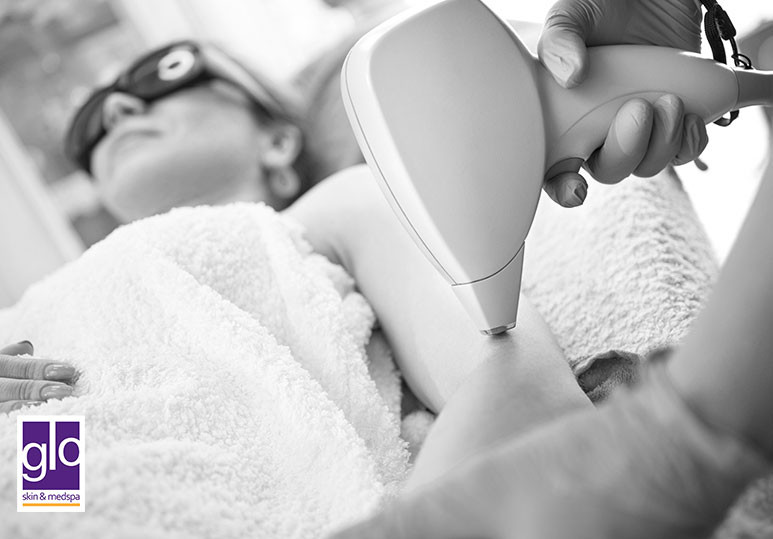 Glo Skin & Medspa | Follow These 3 Tips To Get The Most Out Of Your Laser Hair Removal Res