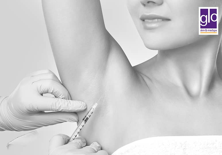Glo Skin - Blog - The Benefits Of BOTOX For Hyperhidrosis