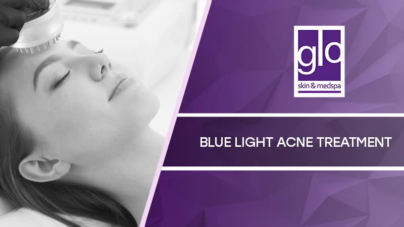 Blue Light Acne Treatment