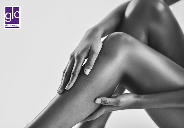 6 Incredible Benefits of Opting For Laser Hair Removal 