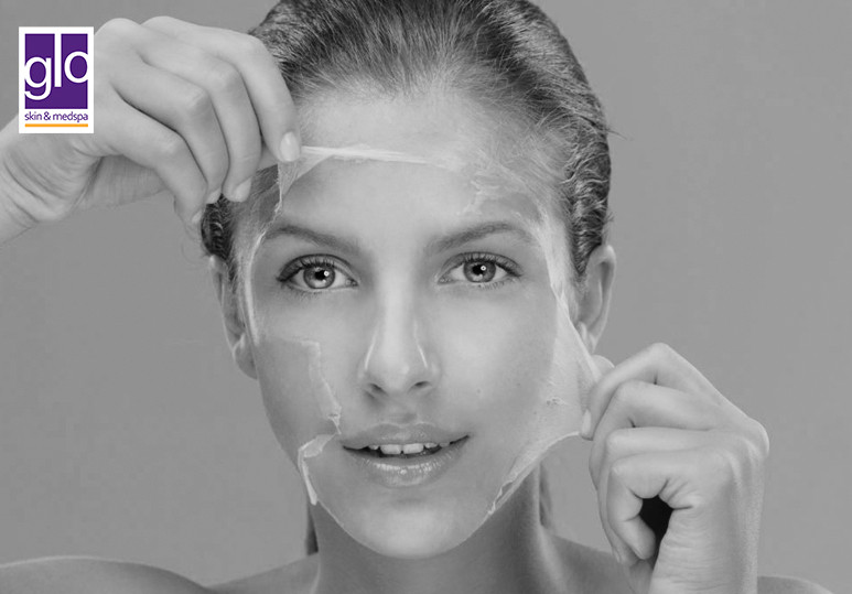 3 Reasons To Get A Chemical Peel This Spring