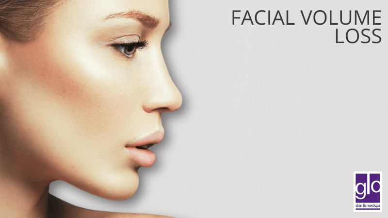 Facial Volume Loss