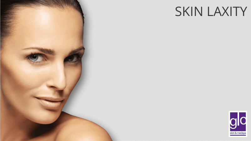 Skin Laxity