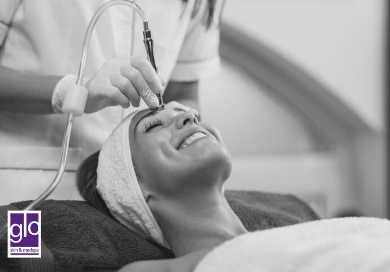 What Is Microdermabrasion and How Can It Improve Your Skin?