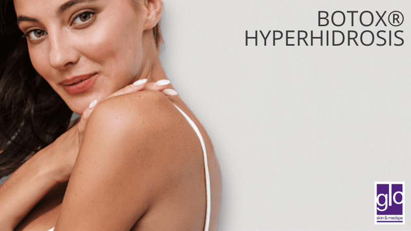 BOTOX® Hyperhidrosis