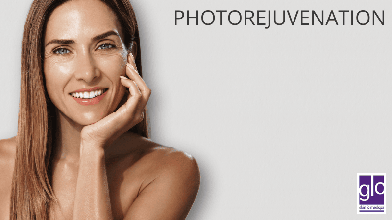 Photorejuvenation