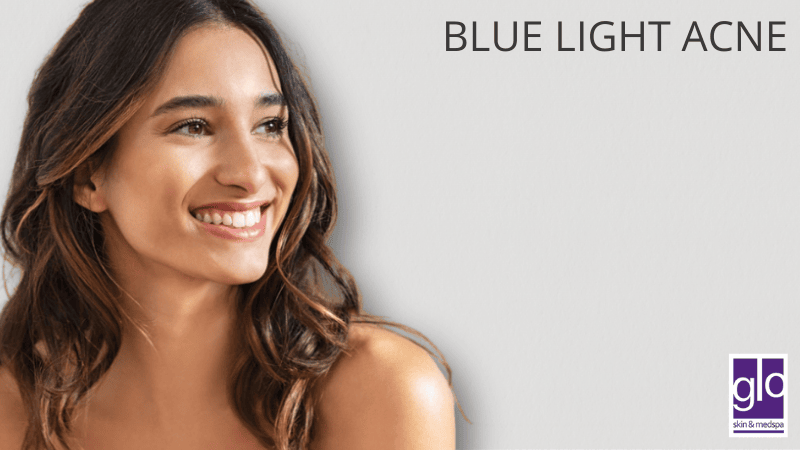 Blue Light Acne Treatment