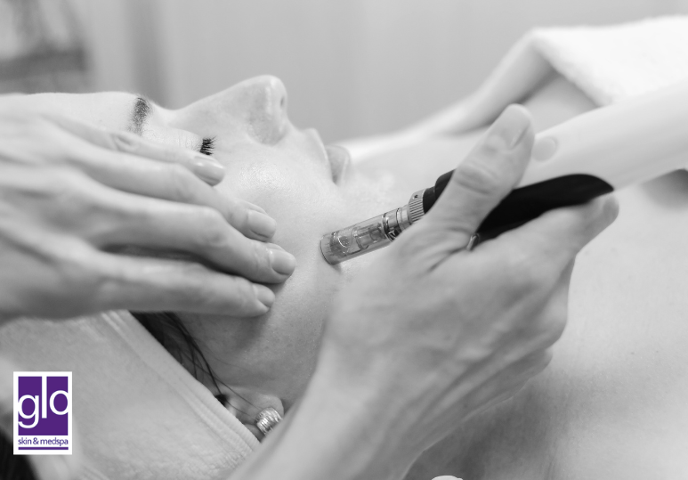 Top 5 Medspa Treatments to Prep for Holiday Season Events 