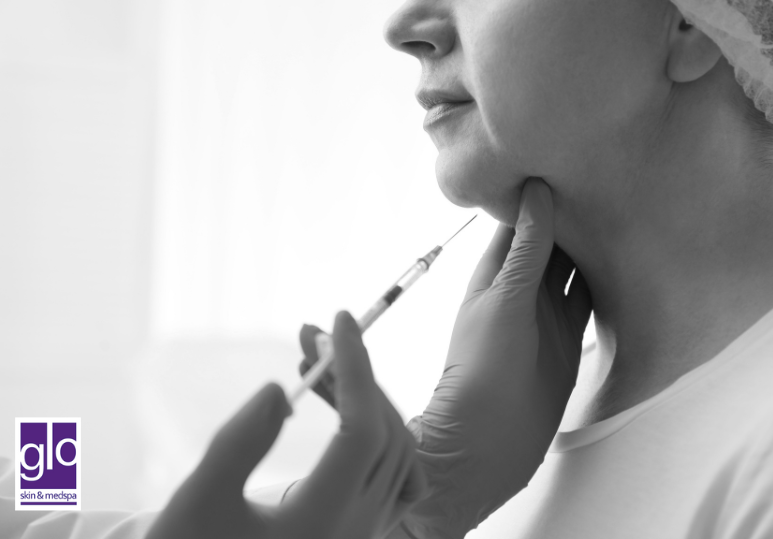 Belkyra for Double Chin: What to Expect From This Non-Surgical Treatment 