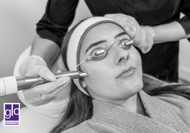 Clear & Brilliant vs Chemical Peels: Which Treatment Is Right for You? 