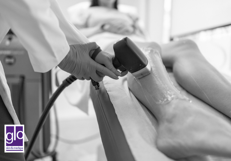 Laser Hair Removal in Winter: Why Now Is the Best Time to Start 