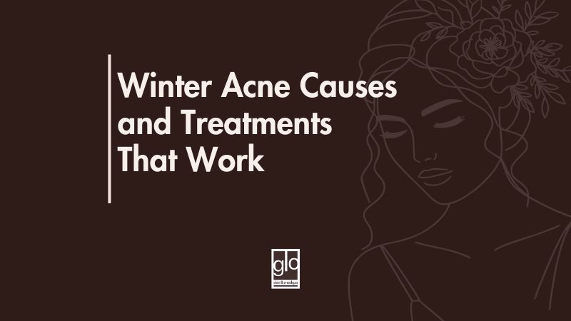 Winter Acne Causes and Treatments That Work - Acne Treatment Edmonton