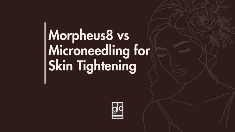 Morpheus8 vs Microneedling for Skin Tightening - Microneedling Edmonton