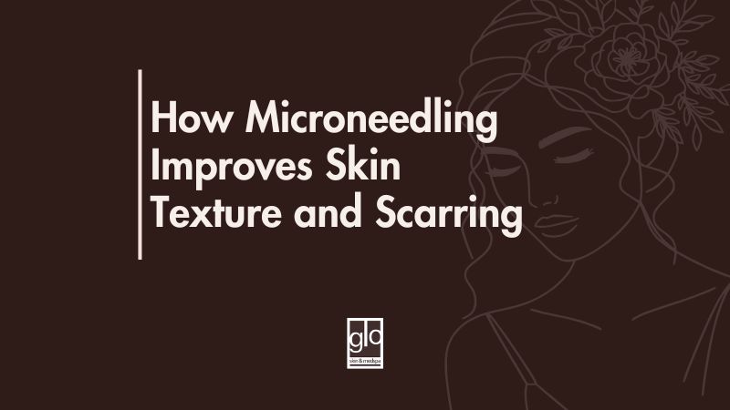 How Microneedling Improves Skin Texture and Scarring - Microneedling Edmonton