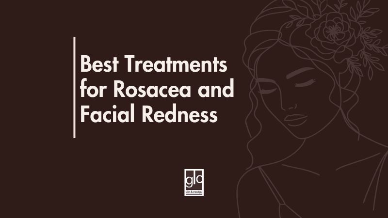 Best Treatments for Rosacea and Facial Redness - Rosacea Treatment Edmonton