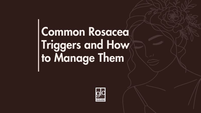 Common Rosacea Triggers and How to Manage Them - Rosacea Treatment Edmonton