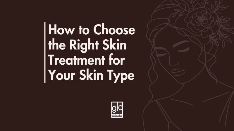 How to Choose the Right Skin Treatment for Your Skin Type