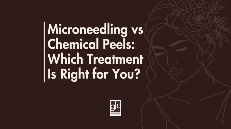 Microneedling vs Chemical Peels: Which Treatment Is Right for You?