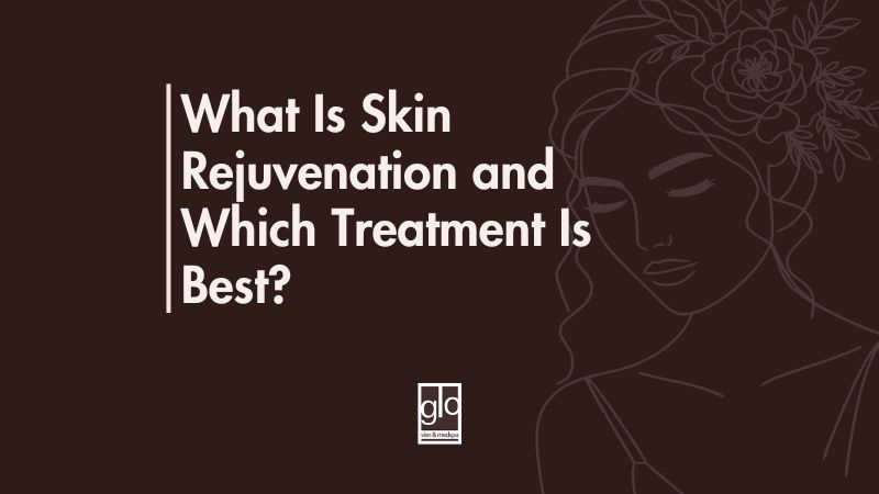What Is Skin Rejuvenation and Which Treatment Is Best?