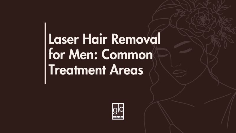 Laser Hair Removal for Men: Common Treatment Areas